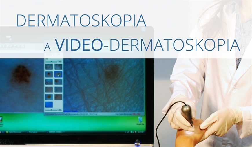 Dermatoskopia a video-dermatoskopia